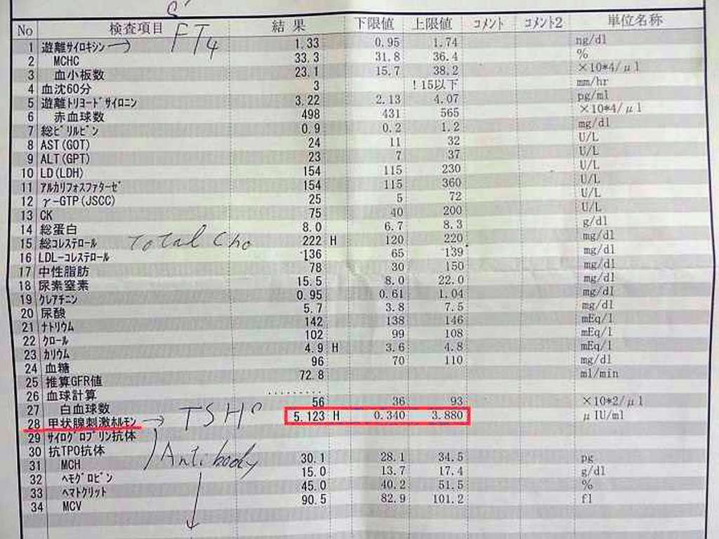 analisis sangre tiroides hipotiroidismo tsh japon