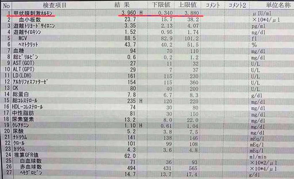 analisis sangre tiroides hipotiroidismo tsh japon